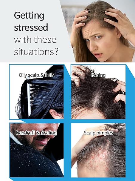 Ballvic Sebo Shampoo – Scalp Balance & Soothing Care, 500g (17.6 oz)