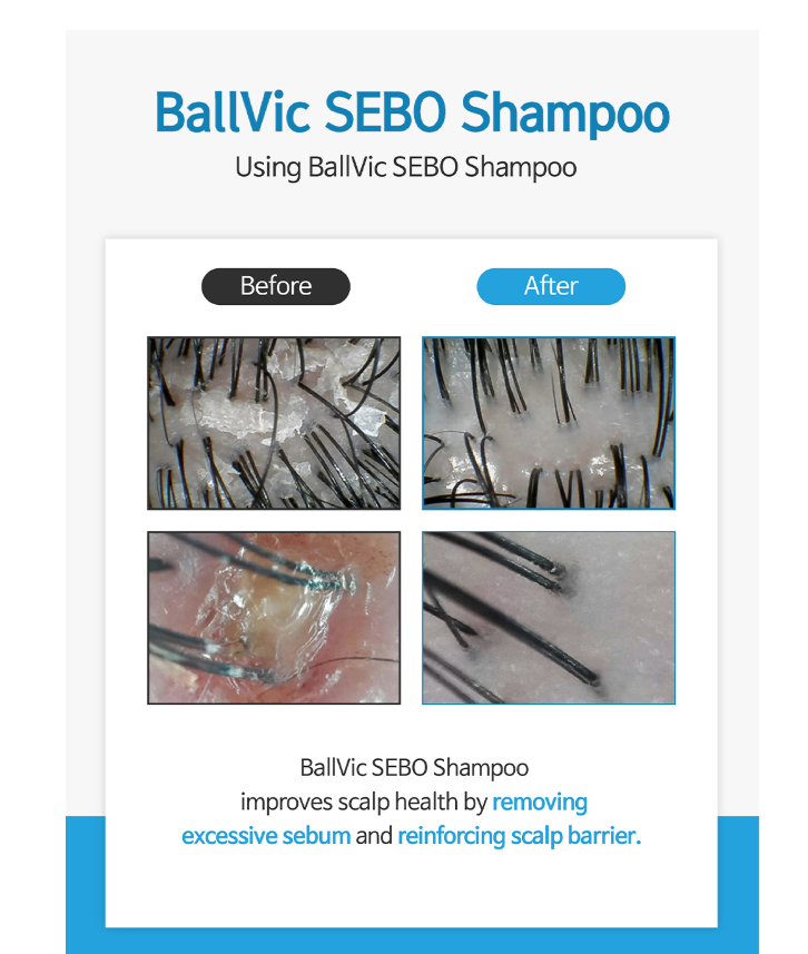 Ballvic Sebo Shampoo – Scalp Balance & Soothing Care, 500g (17.6 oz)