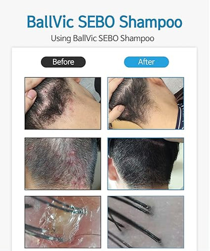 Ballvic Sebo Shampoo – Scalp Balance &amp; Soothing Care, 500g (17.6 oz)