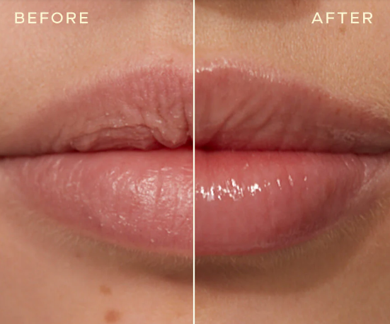 Snowtox Crystal Volume Lip Plumper – Hydration &amp; Glossy Lip Care, 3g (0.11 oz)